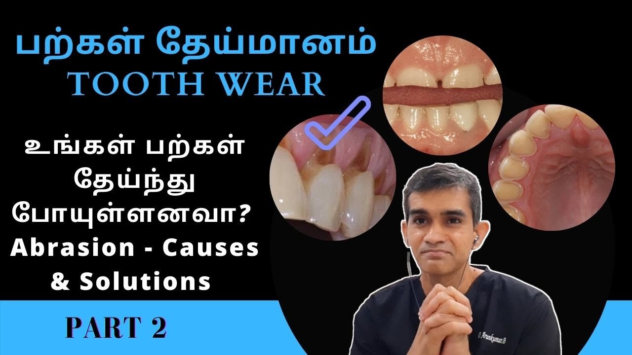 பற்கள் தேய்மானம் Tooth Wear | உங்கள் பற்கள் தேய்ந்து போயுள்ளனவா? Dr Arunkumar | Reasons & Solutions