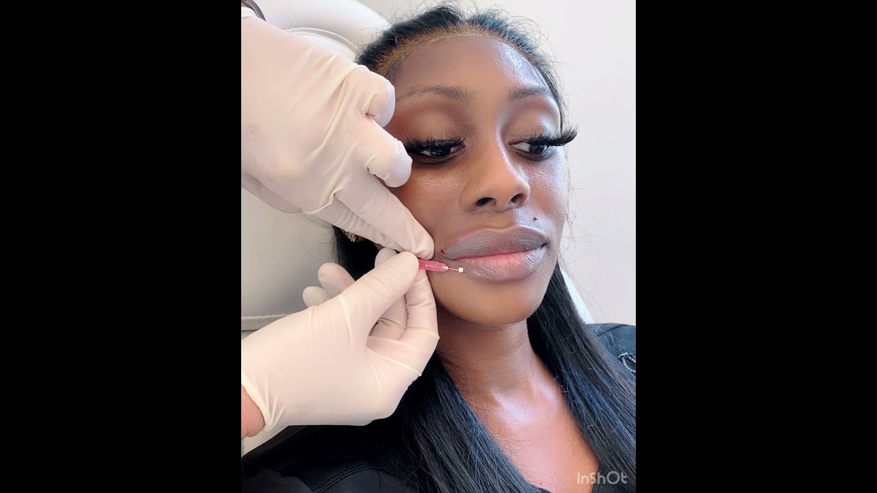 Creating a Lip Border Using PDO Threads