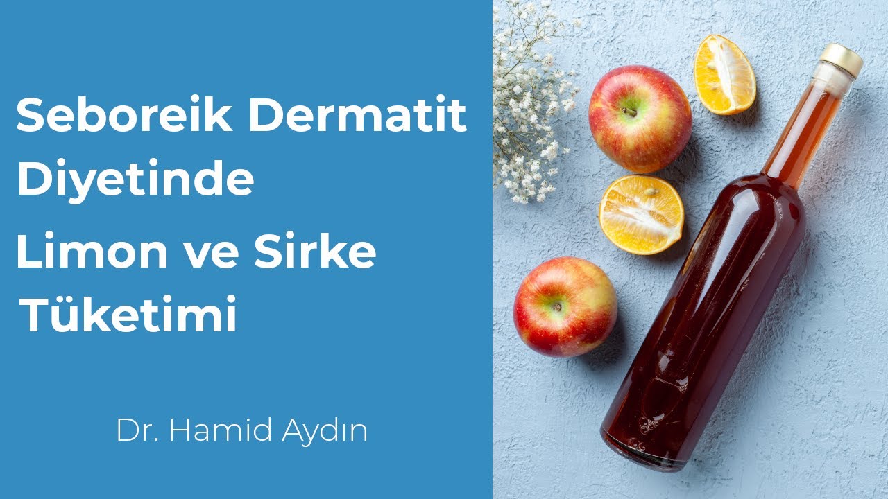 Seboreik Dermatit Diyetinde Limon ve Sirke Tüketimi Nasıl Olmalı