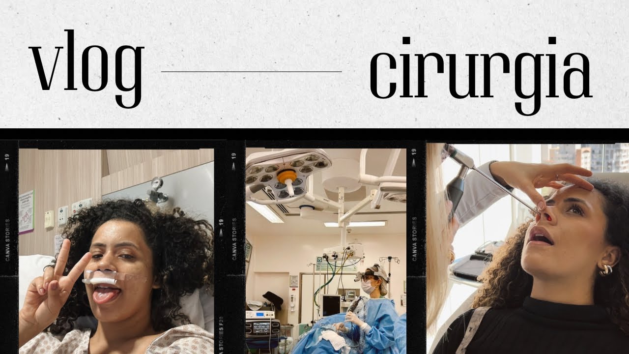 MINHA CIRURGIA- DESVIO DE SEPTO E SINUSECTOMIA