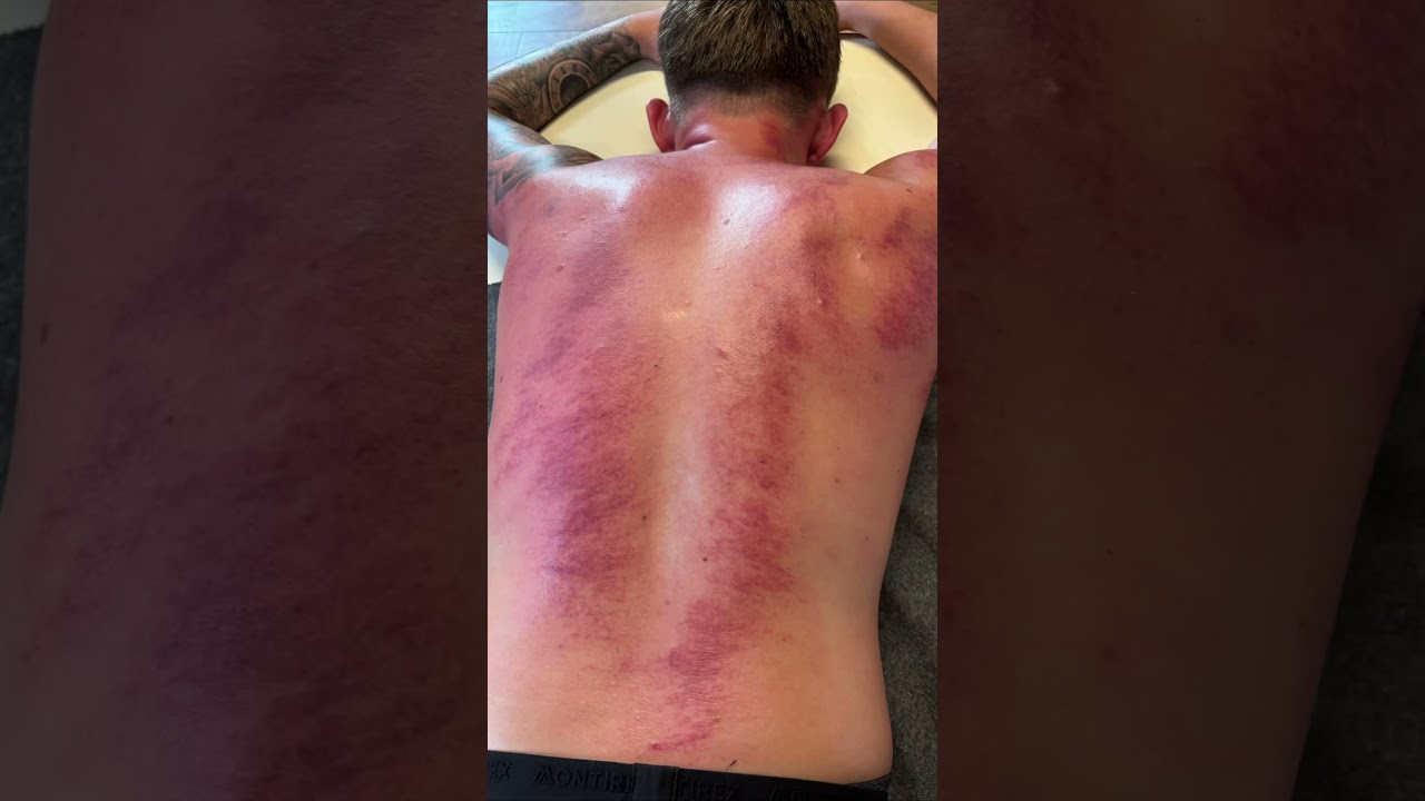 🥊 5 Months Out. Body in Bits. Back in the Game.