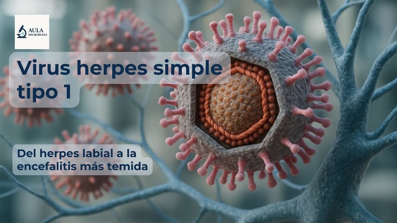 Virus herpes simple tipo 1