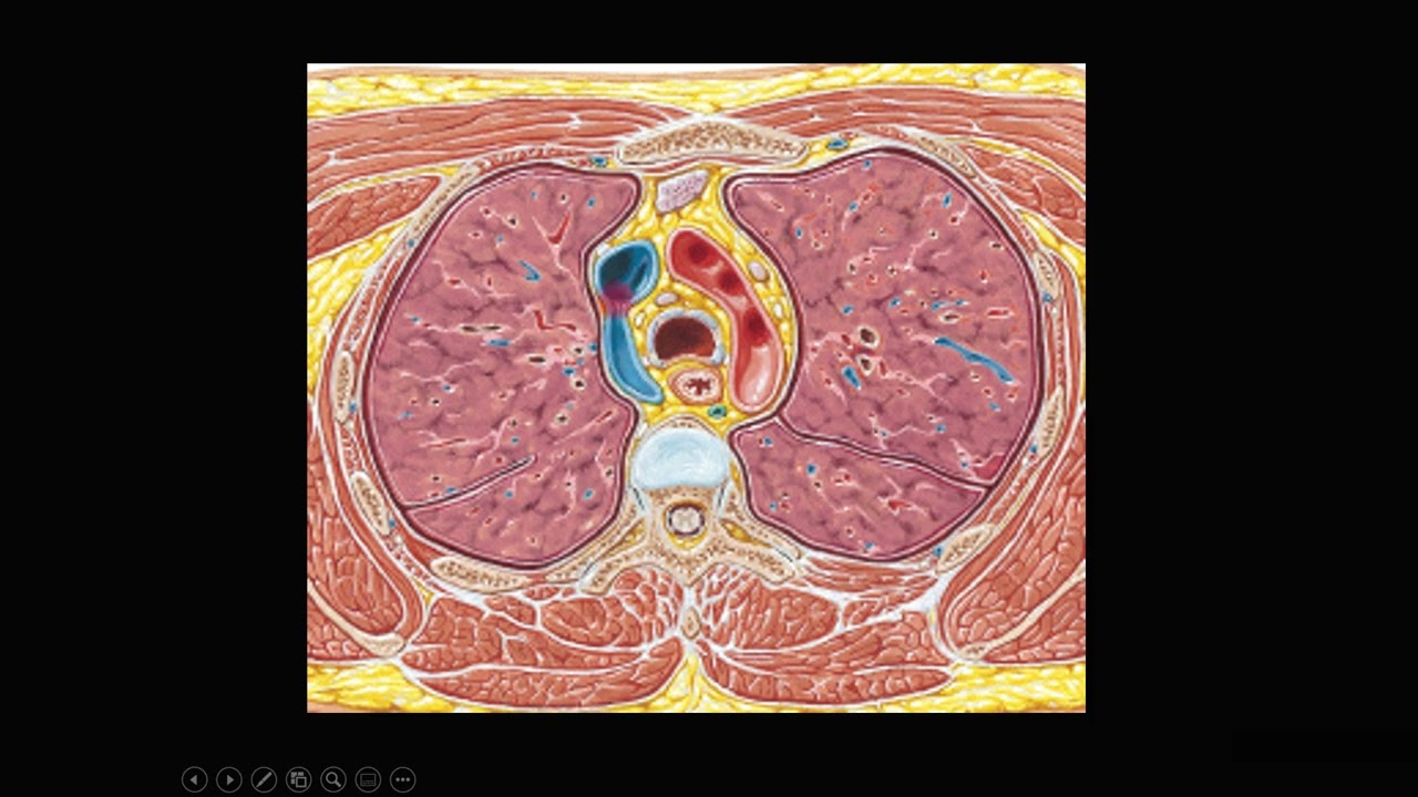 ANATOMIA DO MEDIASTINO NA RADIOGRAFIA E TOMOGRAFIA
