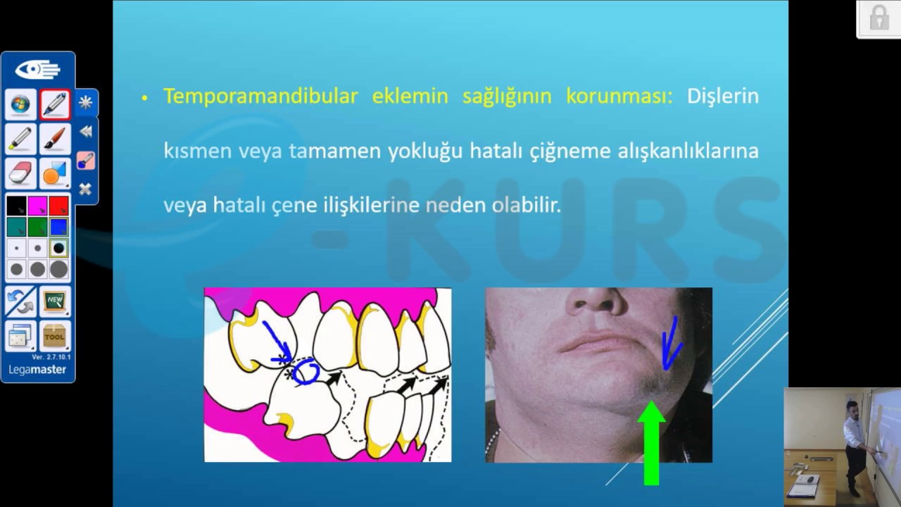 Online DUS Dersleri - Protetik Diş Tedavisi / nettekurs.com - Online DUS Kursu