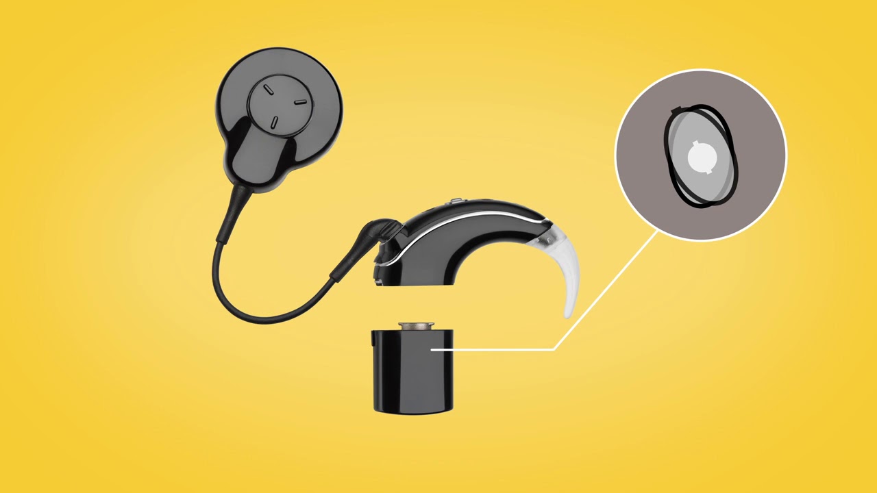 Montaje y encendido del procesador de sonido Nucleus® 7