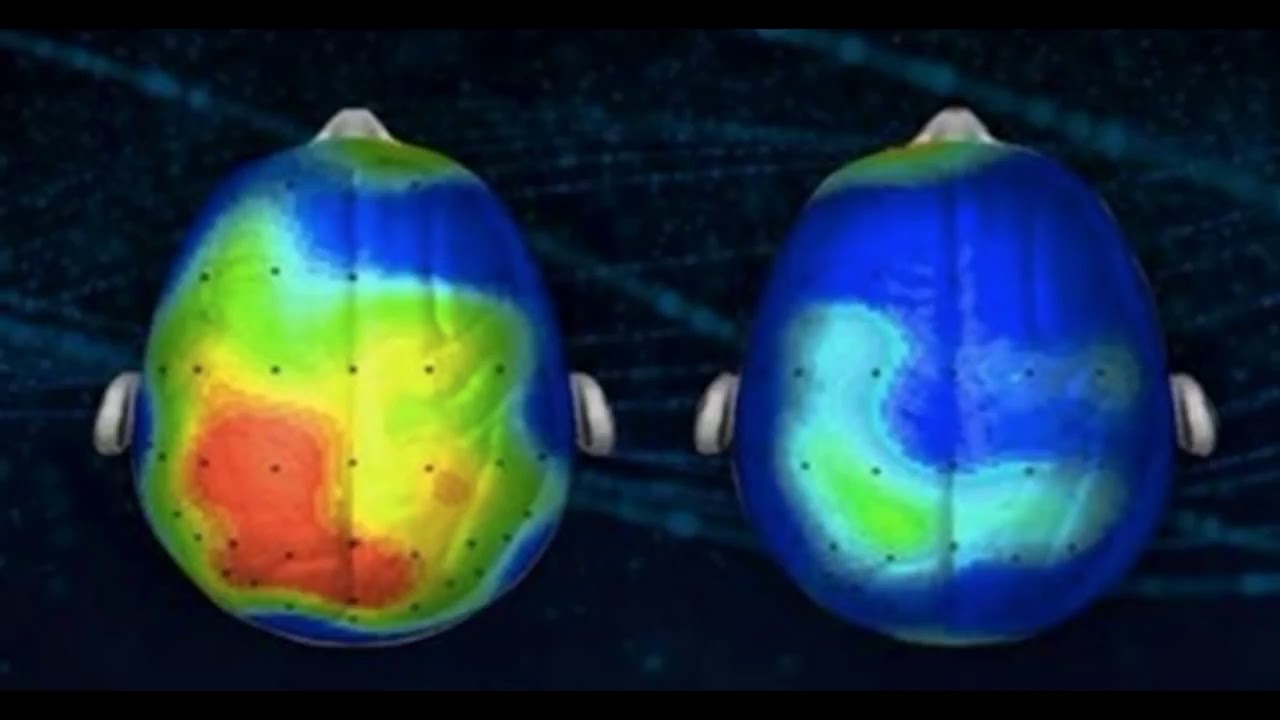 Cient&iacute;stas descobrem musica contra ansiedade - Relaxing Song