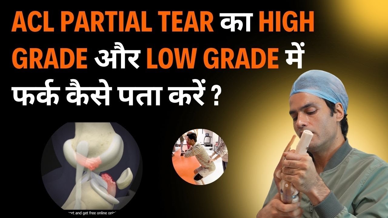 ACL Partial Tear का High Grade और Low Grade में फर्क कैसे पता करें ?