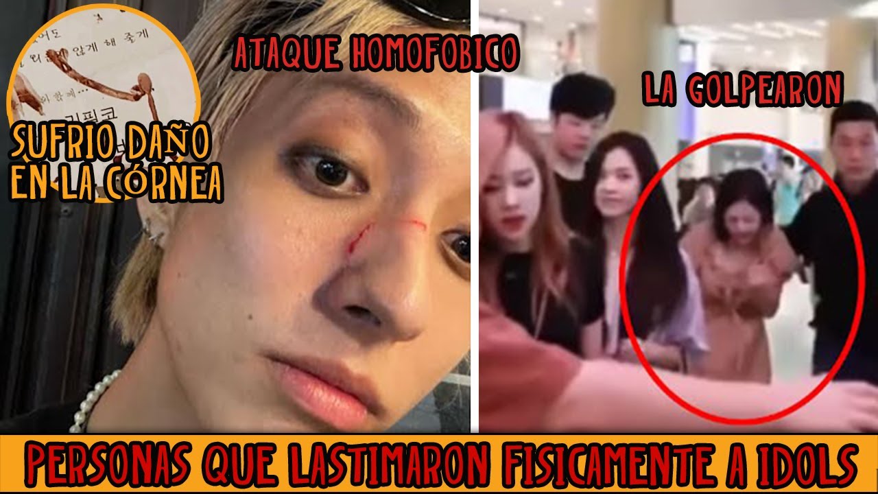 Personas que LASTIMARON FISICAMENTE a Idols