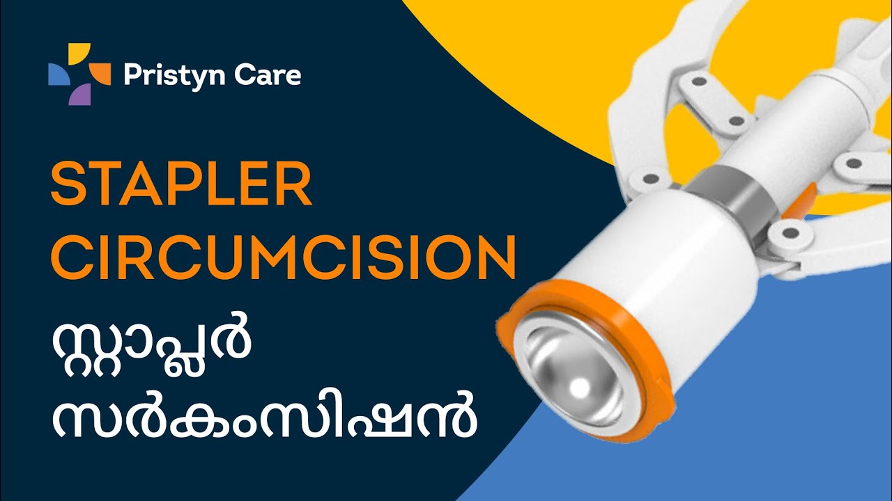 Circumcision treatment in Malayalam| Book FREE Appointment 📞9211990265