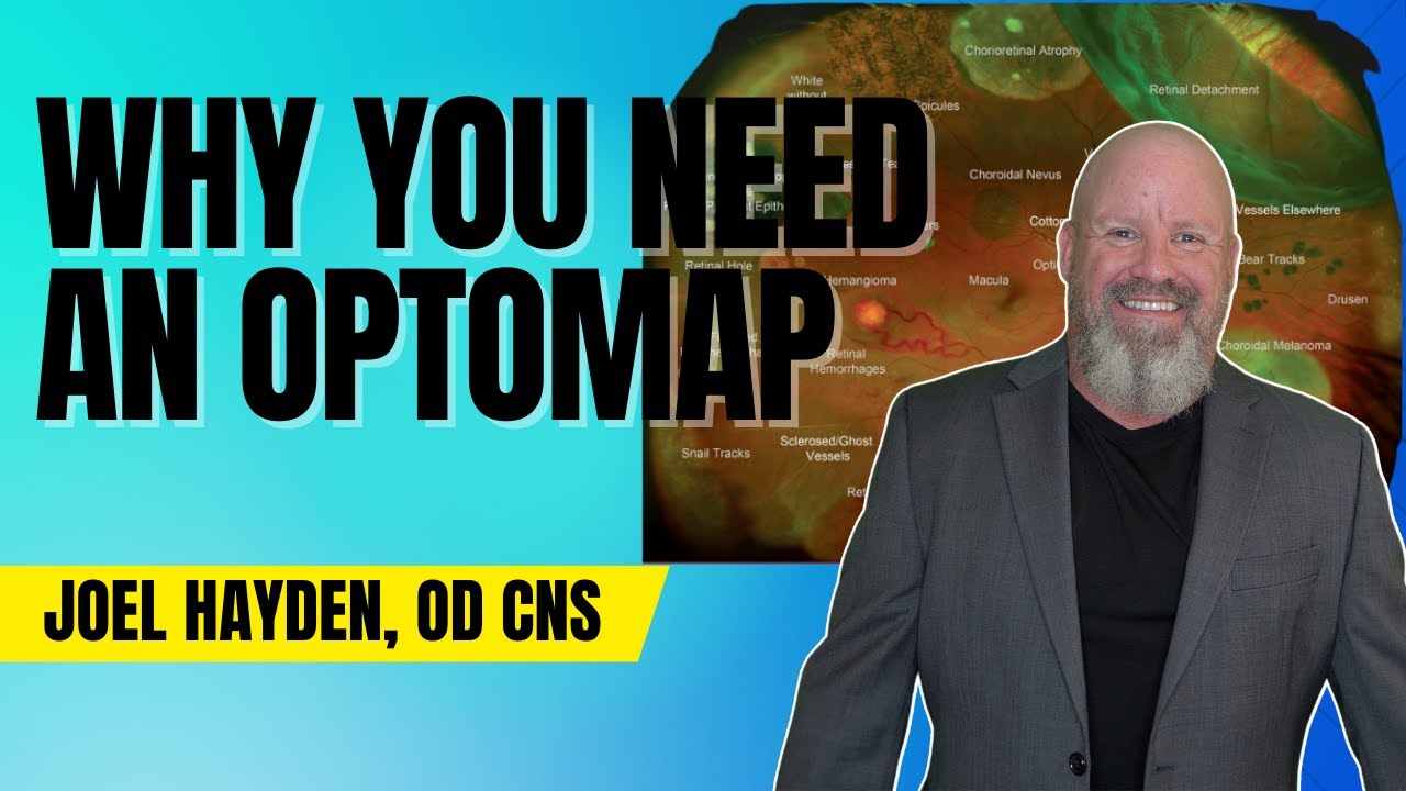 Optomap: The Amazing Device That'll Change the Way You see the World!