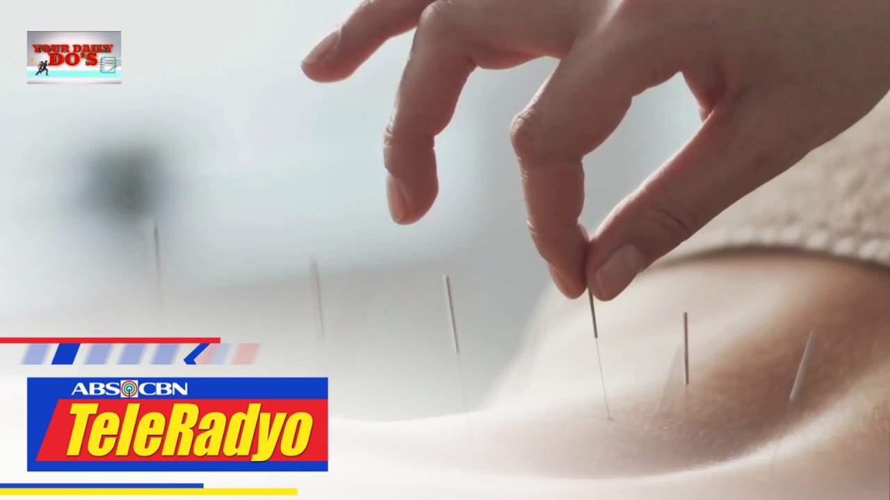 Mga benepisyo ng acupuncture sa ating katawan | Your Daily Do's (22 April 2022)