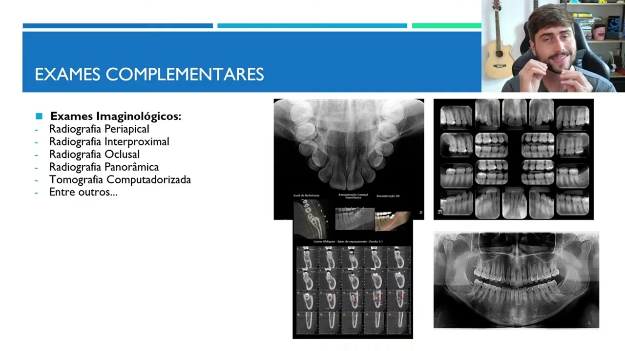 Exames Complementares: o erro que faz dentistas errarem no diagnóstico