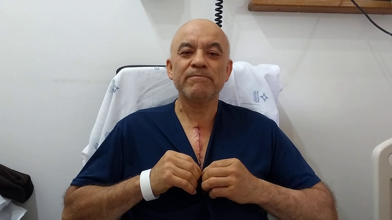 Ponte de Safena 3 – Quarto dia após a cirurgia