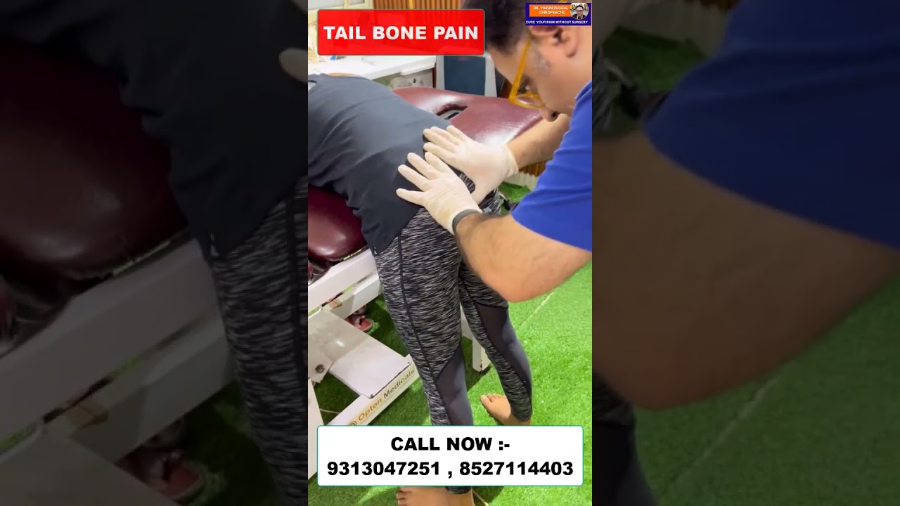 CHIROPRACTIC TREATMENT IN DELHI | TAIL BONE PAIN | DR. VARUN CHIROPRACTOR CALL NOW :- 9313047251