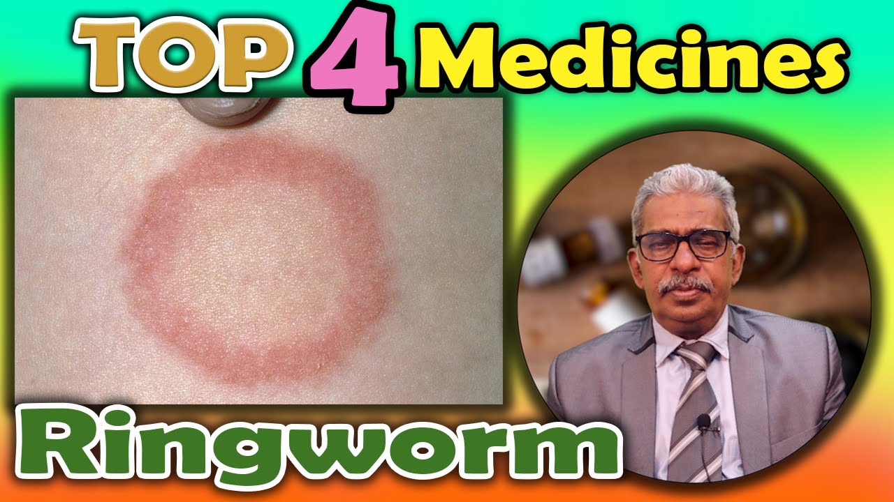 Top 4 - Homeopathy Medicines for Ringworm - Dr P. S. Tiwari