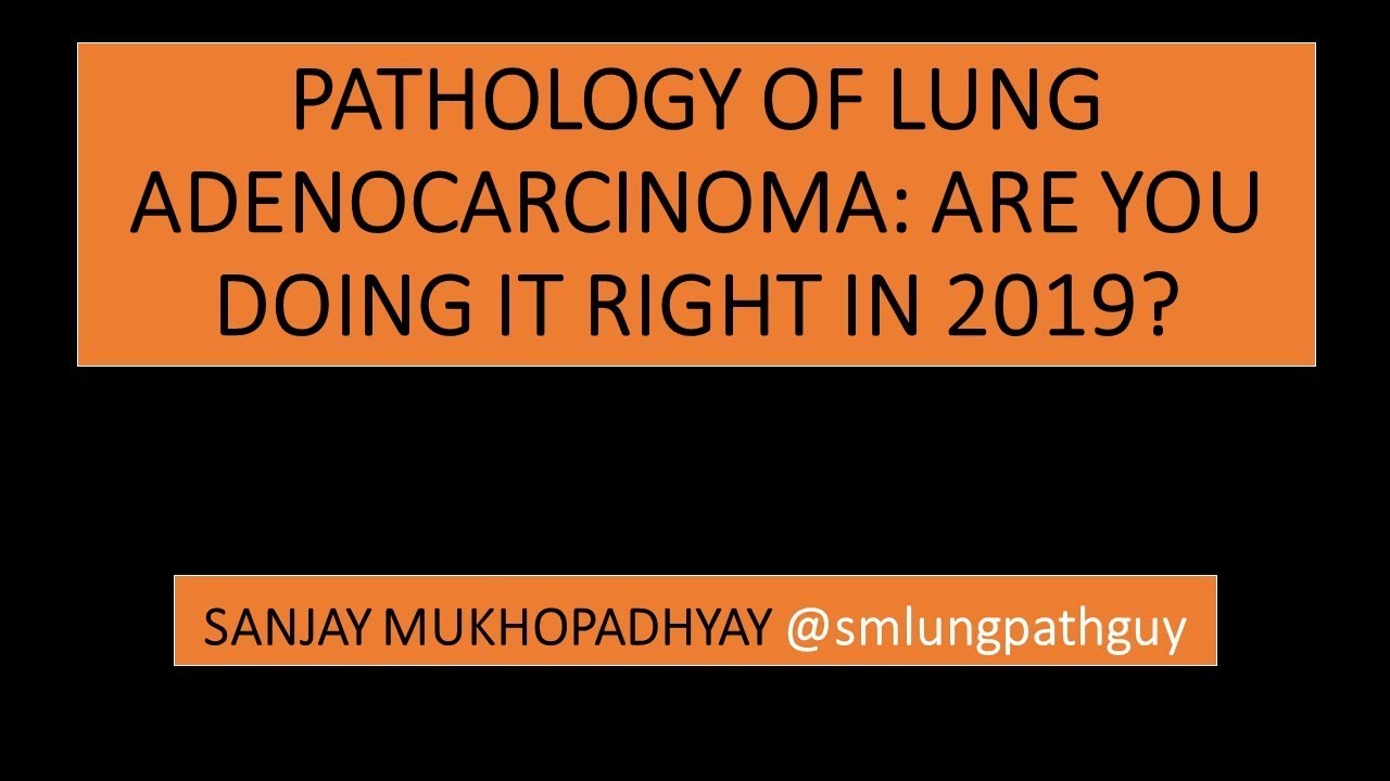 Pathologic Diagnosis of Lung Adenocarcinoma: Are You Doing it Right in 2019?