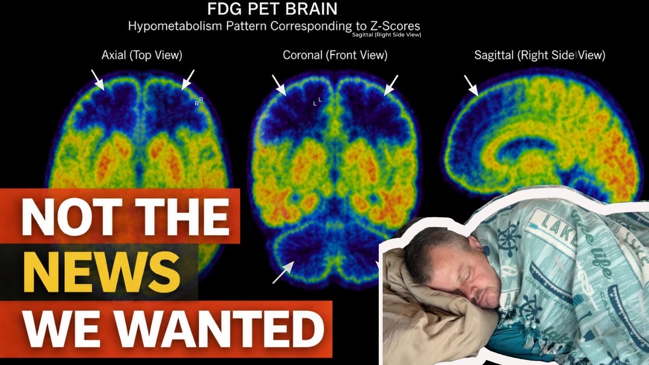 His Brain Scan Changed Dramatically... Here's What It Means