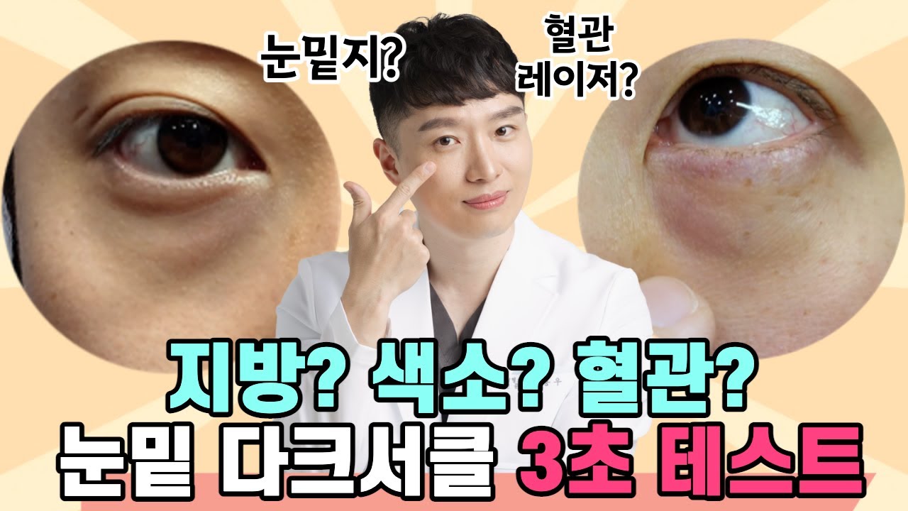 눈밑 색소 & 혈관?  3초 셀프테스트로 OK + 눈밑 유형별 개선법 총정리❗✅