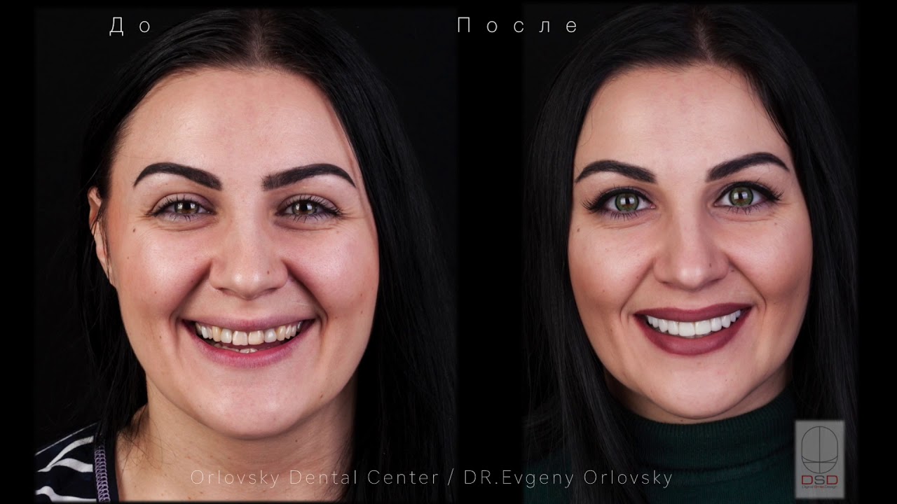 Отзыв Примаковой Екатерины об Orlovsky Dental Center Правобережье, город Калуга