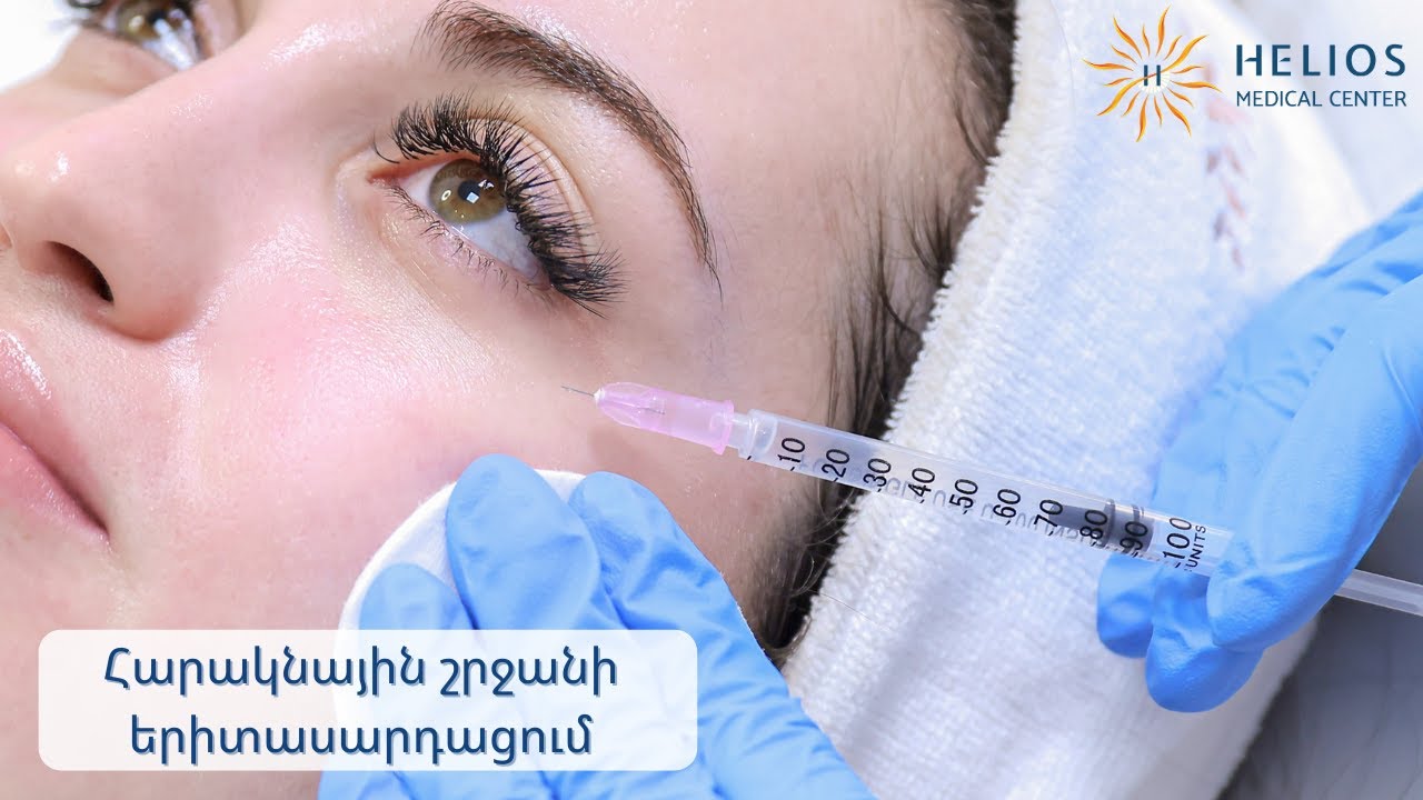 Մոռացե՛ք աչքերի շուրջ մուգ շրջանակների և փոսիկների մասին