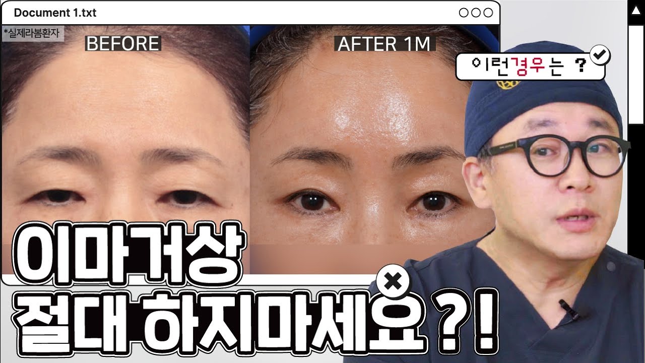 이마거상 진짜 정말 절대 하지마세요?!🤔 이마거상 하면 안되는 케이스 알려드립니다👨‍⚕️