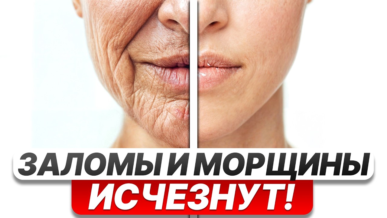 ЛУЧШИЕ и ХУДШИЕ способы убрать морщины БЕЗ ОПЕРАЦИЙ: от 100 до 23 547 РУБЛЕЙ!