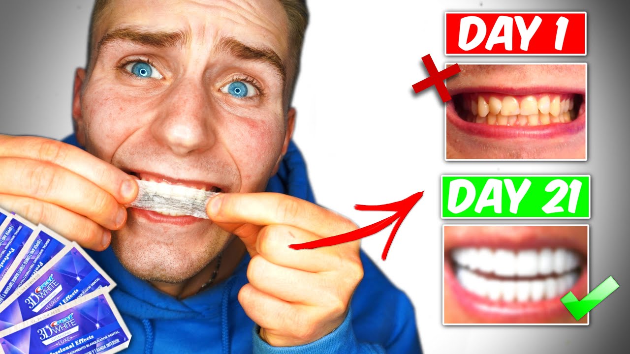 Crest 3D White Strips! Do They Work? 21 day challenge