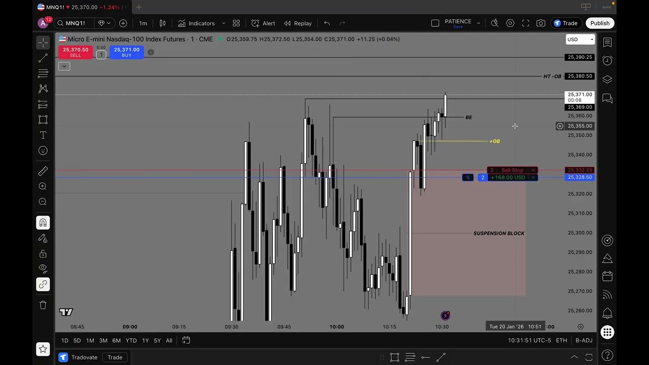 Making $304 Profit | +76 Points on MNQ | Using ICT Concepts