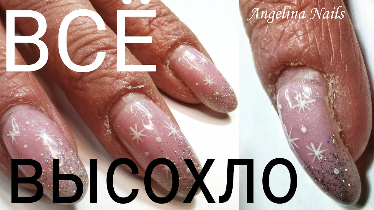ВСЕ СУХОЕ / истончение боковых стенок ногтя / точка вроста в синусах / кто виноват в этом  ???
