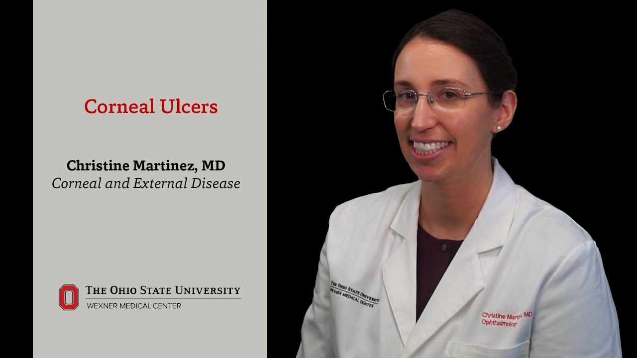 What are corneal ulcers? From Christine Martinez, MD | Ohio State Medical Center