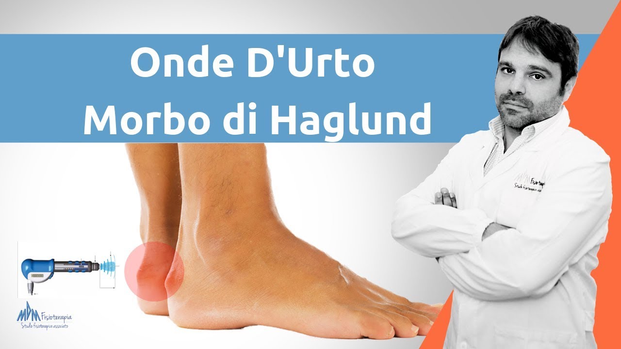 Onde D'urto Morbo di Haglund