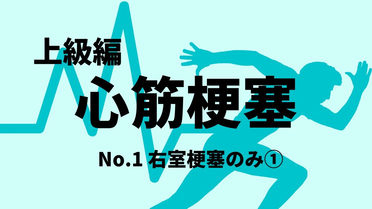 【心電図】心筋梗塞 上級編 No.1 右室梗塞のみ①