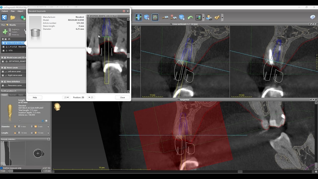 How to Place a sleeve and design a drill guide in coDiagnostiX