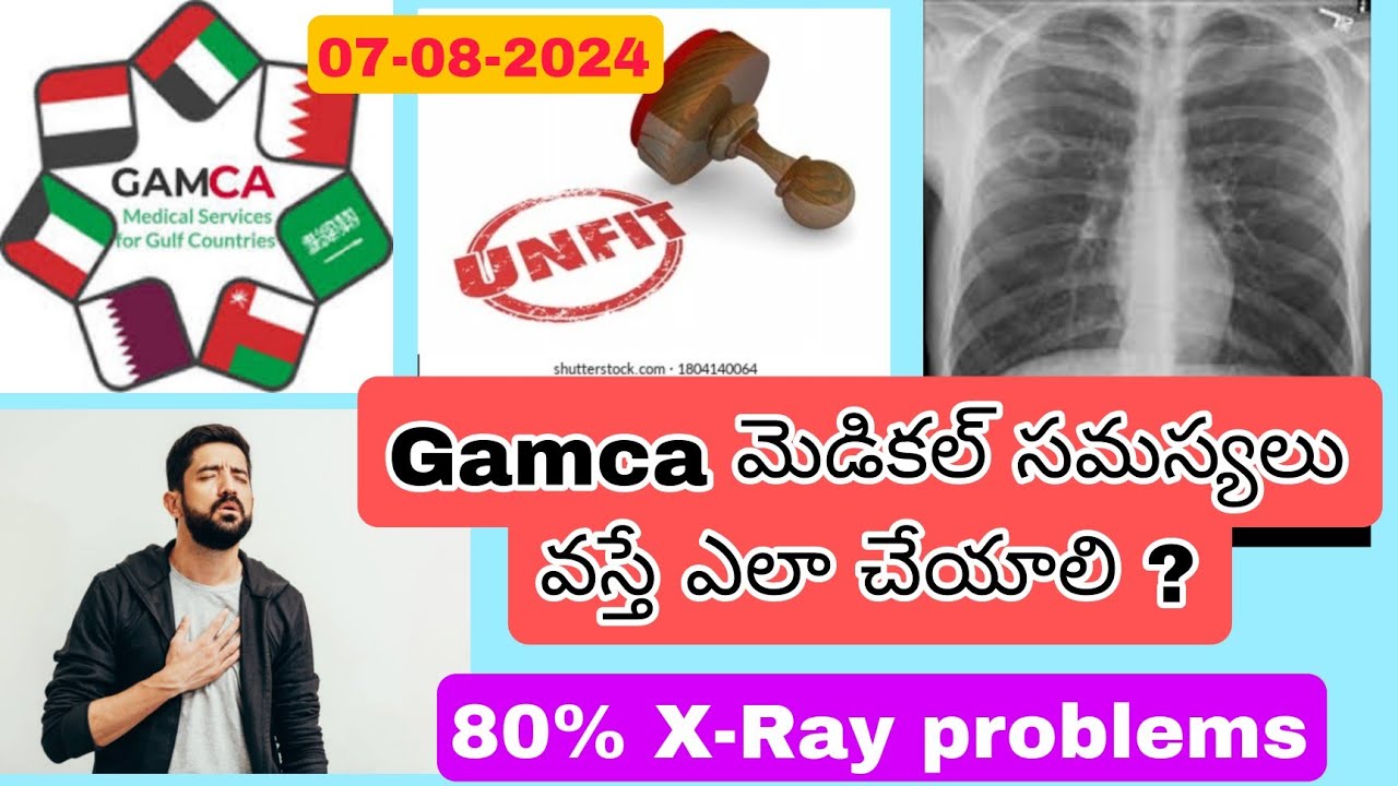 GAMCA Medical Problems How to slove Telugu 07-08-2024 || Gulf News Telugu || X-ray problem