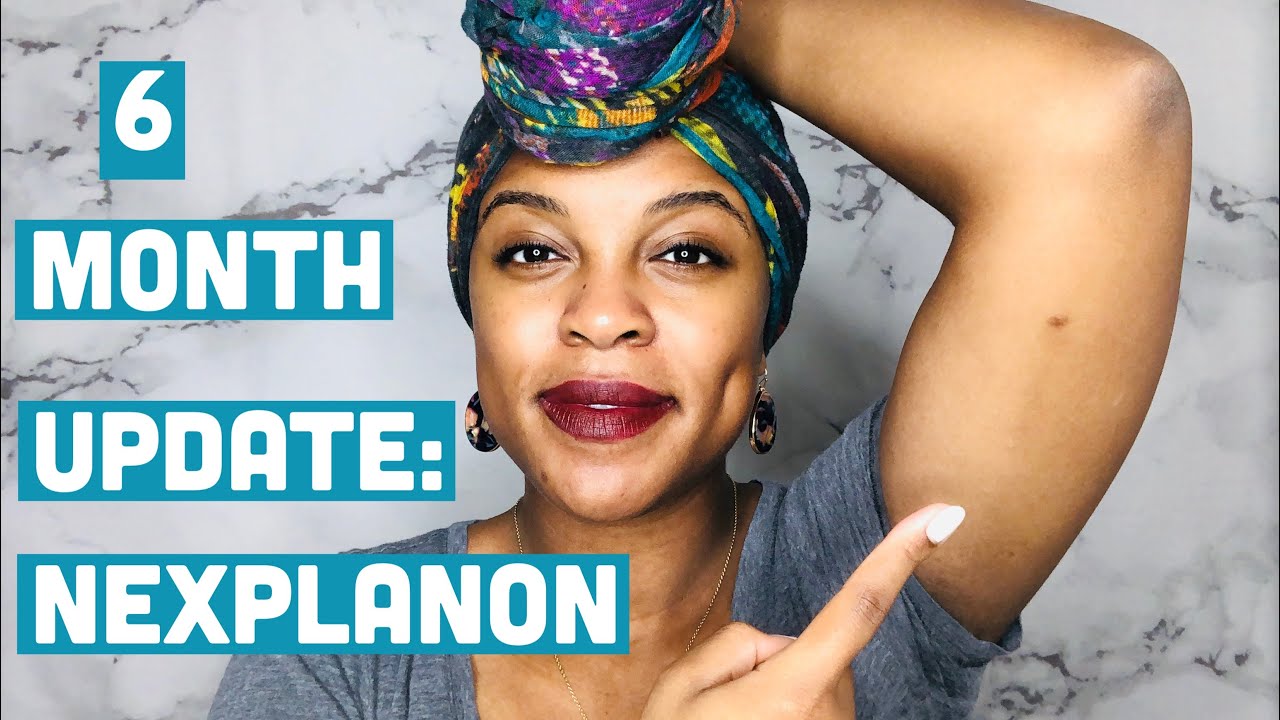Nexplanon Removal 6 Month Update || Regrets? Scars? Emotions? Weight?