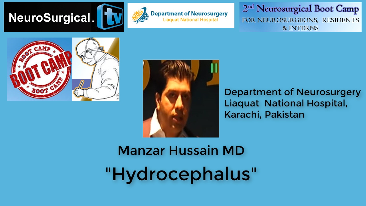 Manzar Hussain MD: Hydrocephalus