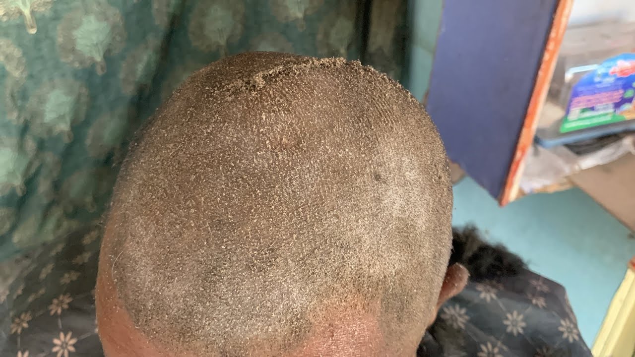 Transformed 💈Long Hair into a Clean Shaved Look with a Machine! 💈ASMR