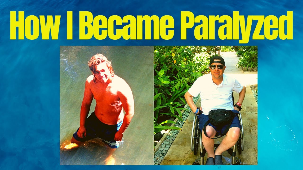 HOW I BECAME PARALYZED - Spinal cord injury (very traumatic)
