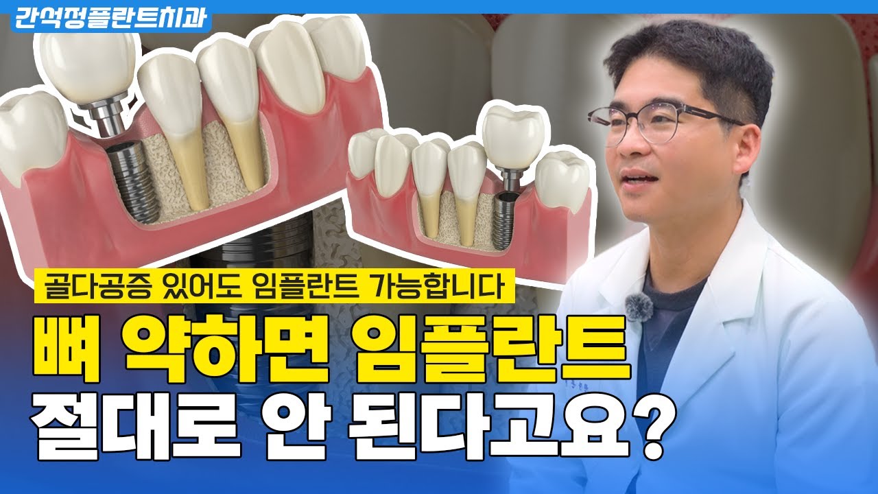 골다공증 있어도 임플란트 가능할까? [치과의사가 직접 알려드립니다]