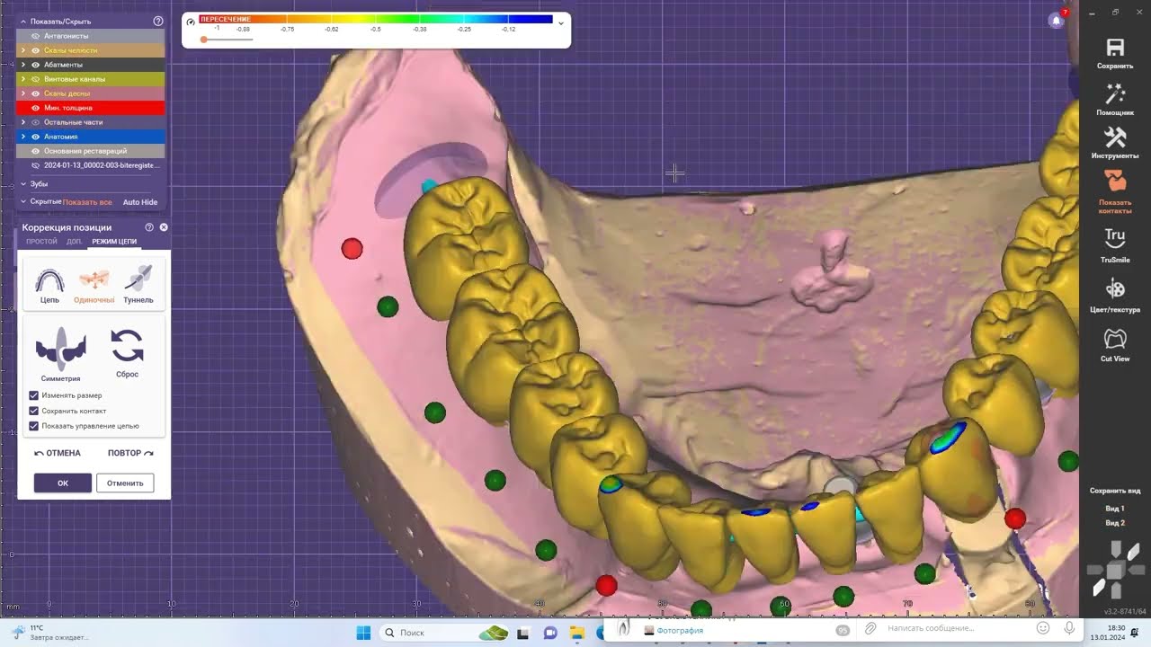 EXOCAD 3.2 Elafsina Total big work fast. Что нового в Exocad 3.2