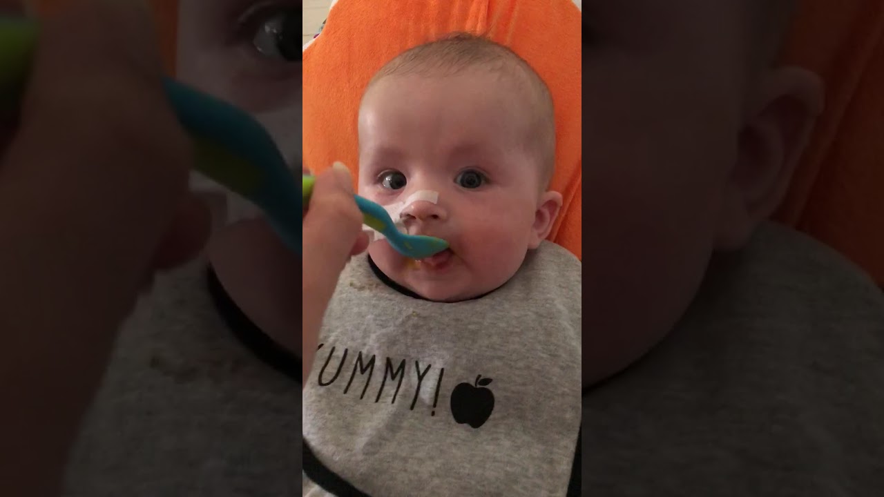 The CDH Mum - New feeding techniques for Alfie due to feeding aversion