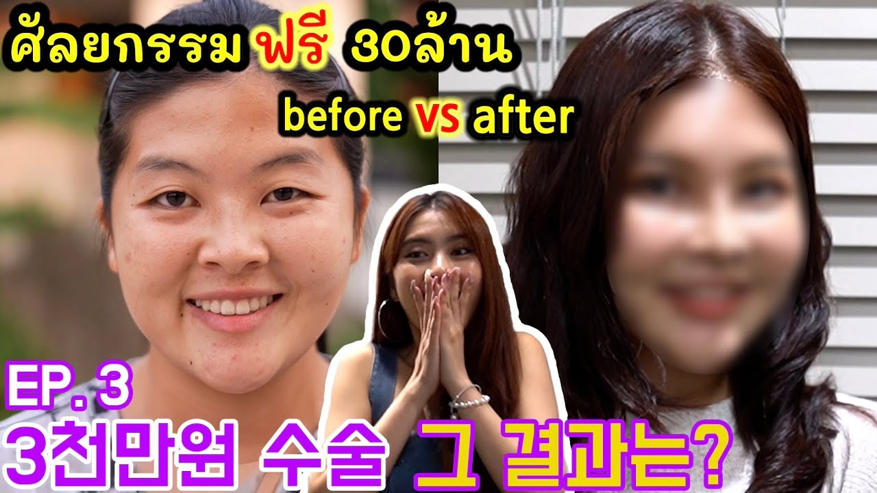 인생 바꾸는 전신성형 Before & AfterㅣWith me in Daegu EP.3