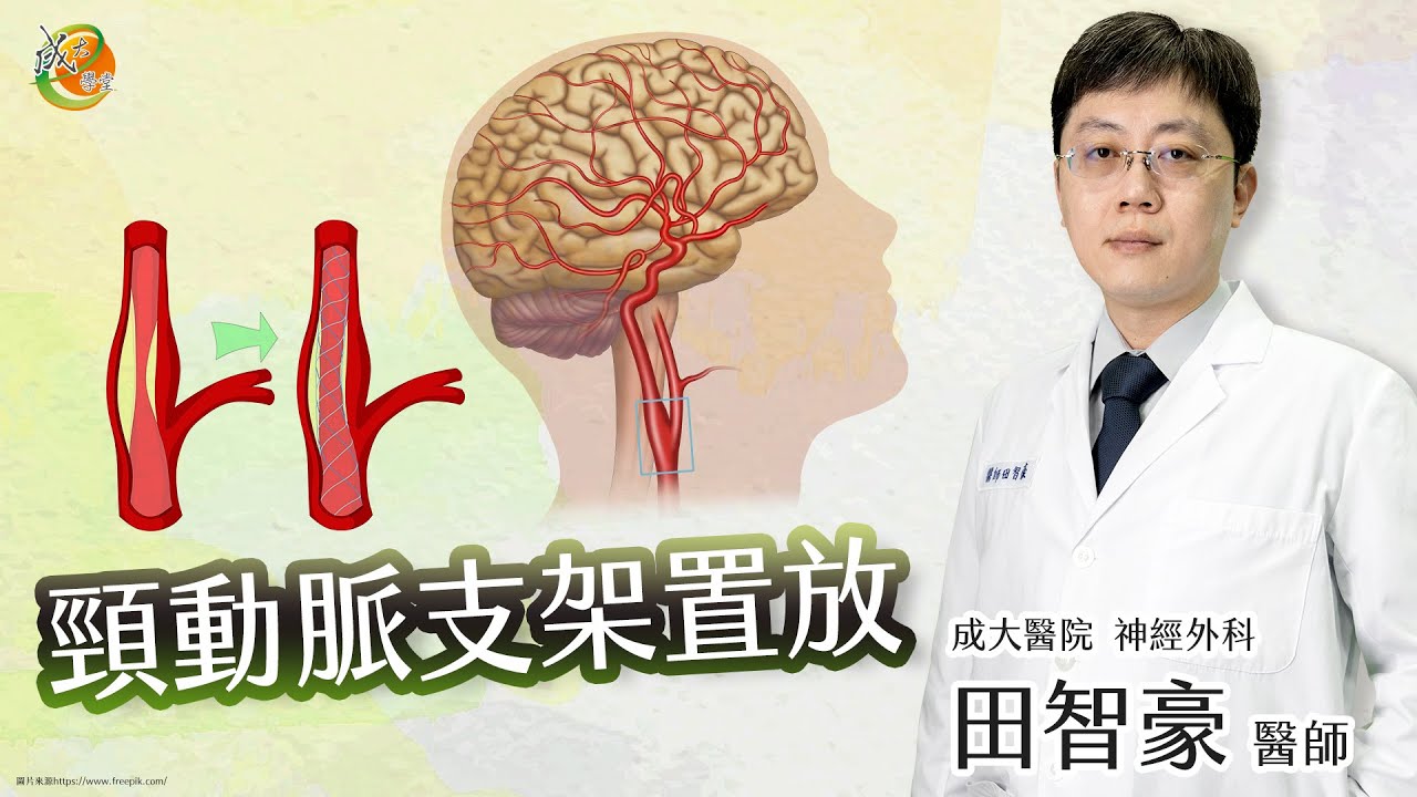 【頸動脈支架置放】田智豪醫師-成大e學堂