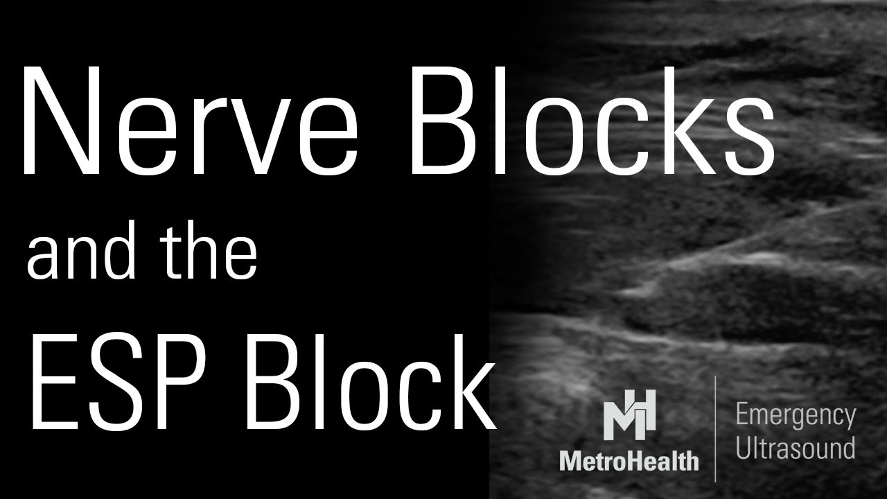 Nerve Blocks and the ESP Block