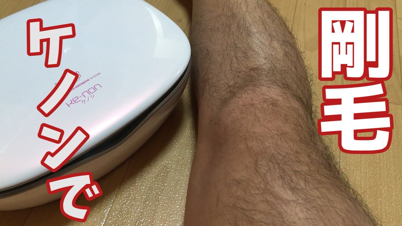 最強の脱毛器ケノンで剛毛すね毛を照射してみたら女子になりましたwｗ【家庭用脱毛器 効果 使い方  】