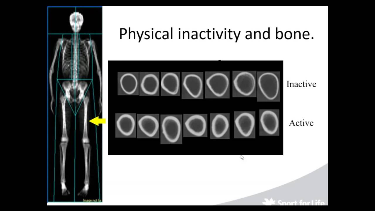 Physical Literacy: What It Is And Why It Is Important
