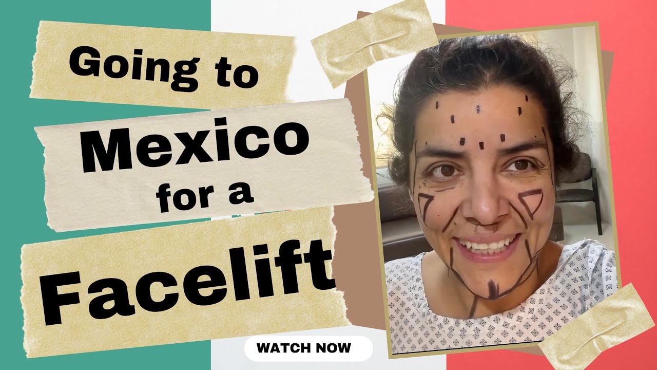 I went to Mexico for a Facelift!