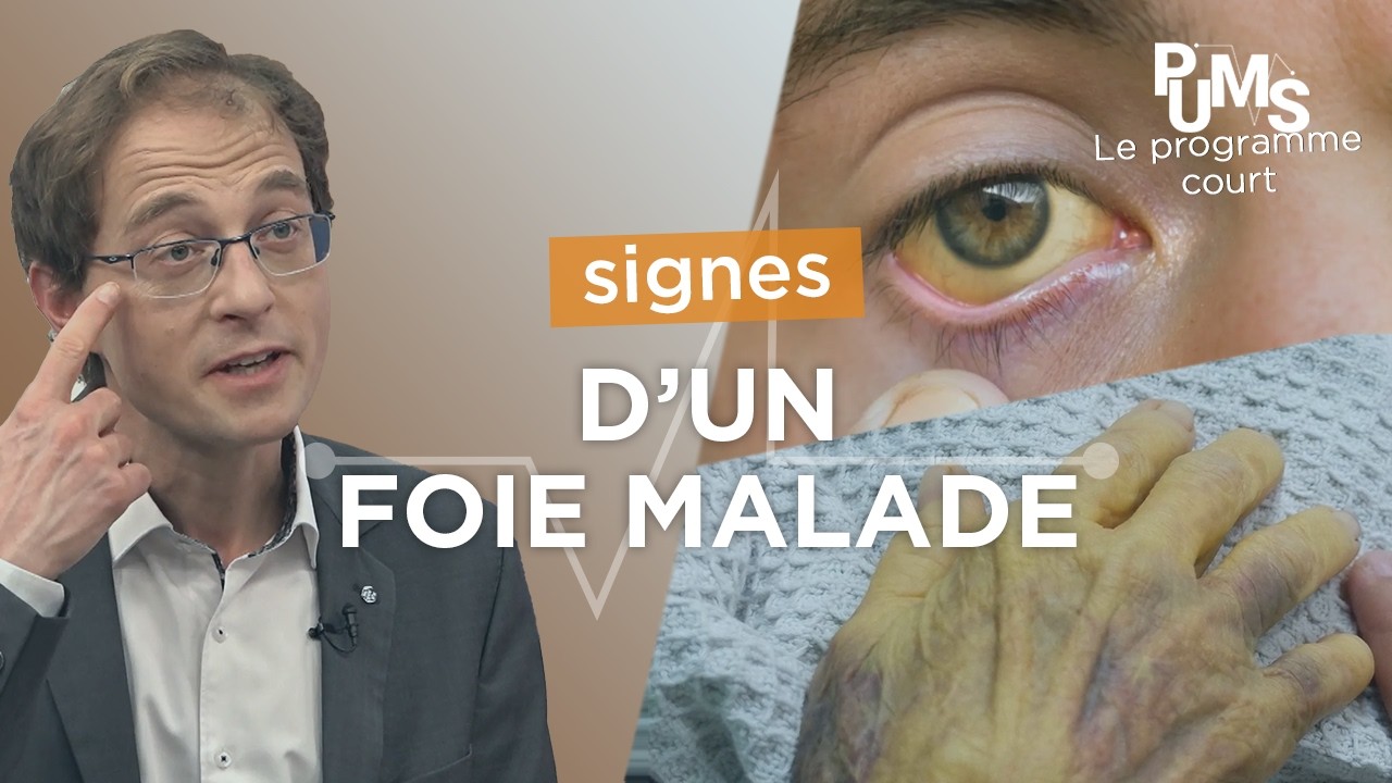 Des YEUX JAUNES : on vous dit ce que ça veut dire.