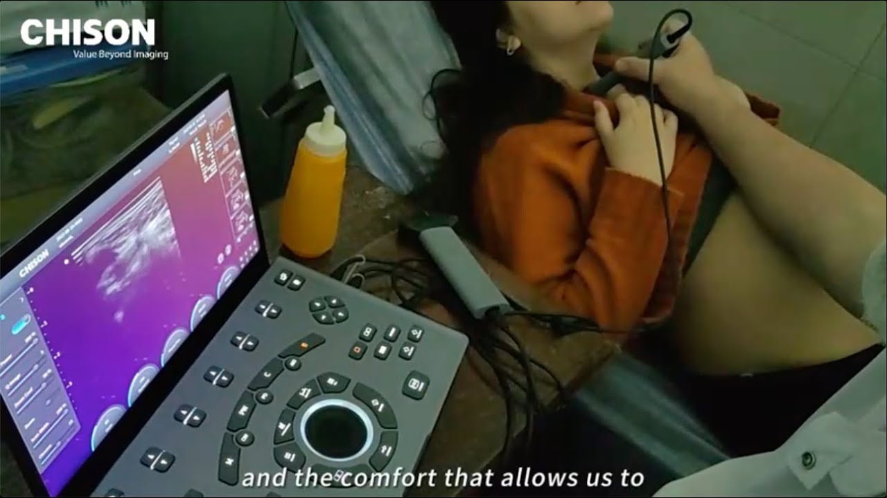 All you need to know about CHISON Ultrasound SonoAir