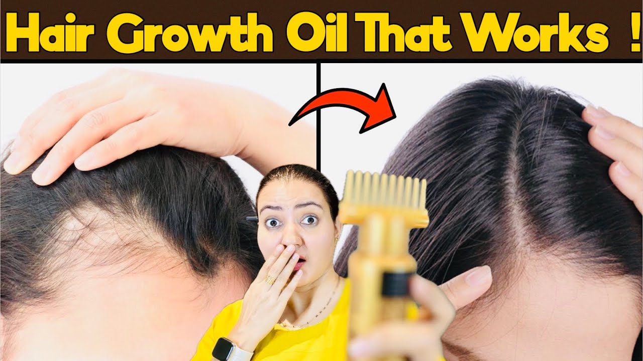 Ayurvedic Secret To Stop Hair fall & Regrow New Hair | आयुर्वेदिक  Hair Oil❤️